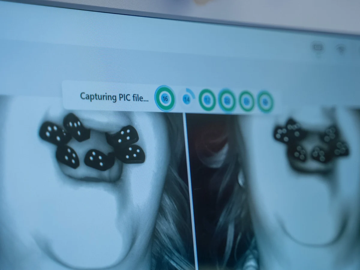 Înregistrarea reperelor PIC Dental pe ecran
